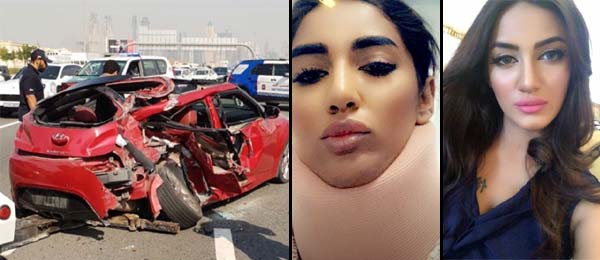 Mathira injured in car accident